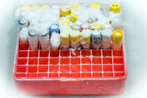 LIMS Freezer Storage